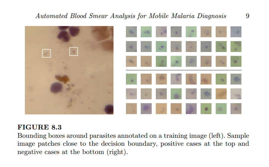 AI-DEV uses supervised learning and computer vision to identify potential infections
